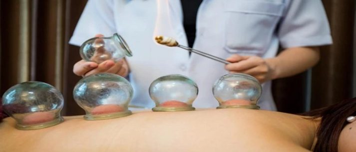 yiwu cupping massage